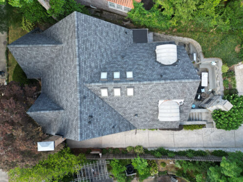 shingles